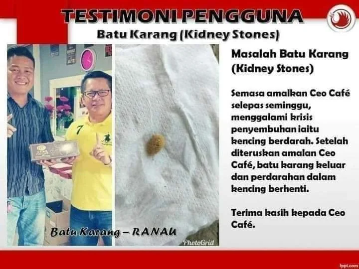 Testimoni pengguna - Yung Kien Twinpack + Kopi CEO